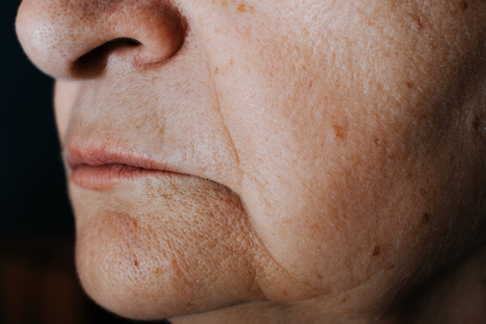 Loose or Sagging Skin