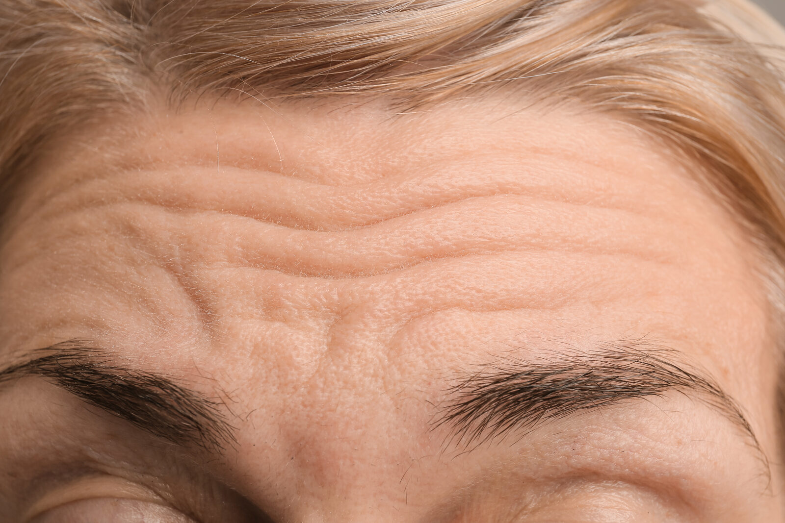 Wrinkles & Fine Lines