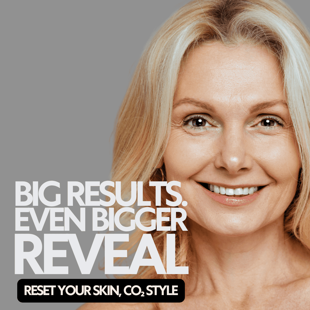 CO₂ Laser in Westfield & Carmel - RELUXE Med Spa