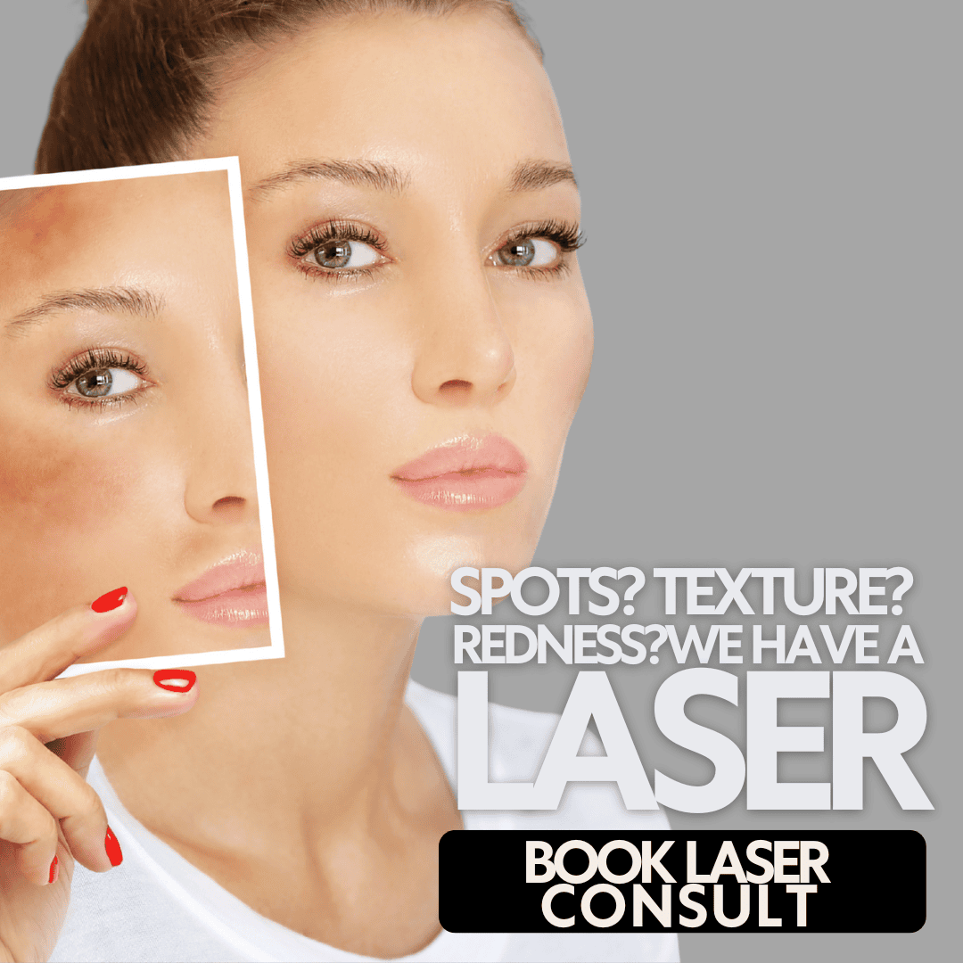 Lasers in Westfield & Carmel - RELUXE Med Spa