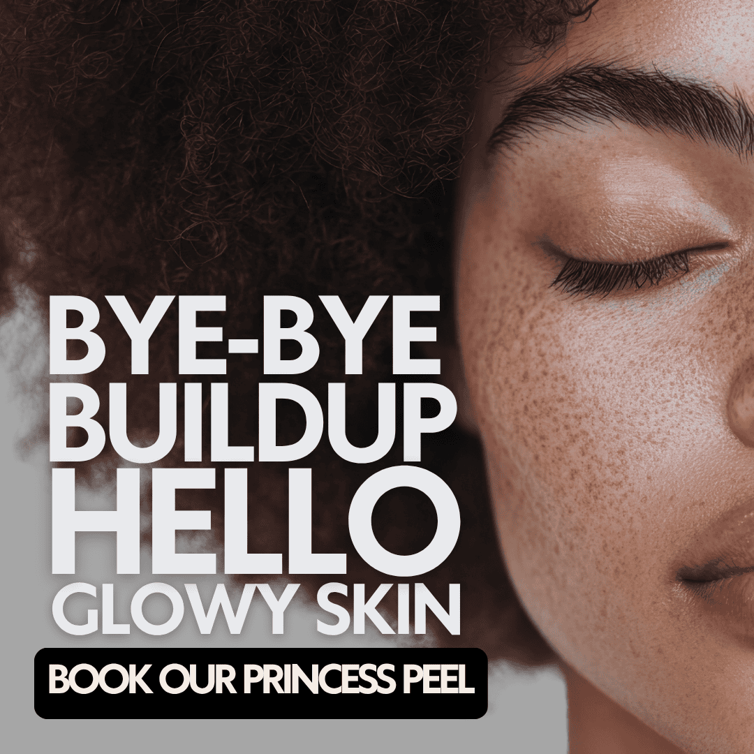 Peels in Westfield & Carmel - RELUXE Med Spa