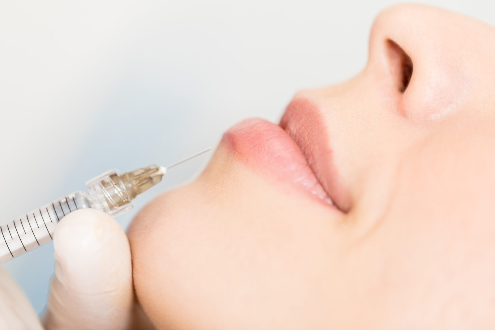 Dermal Fillers