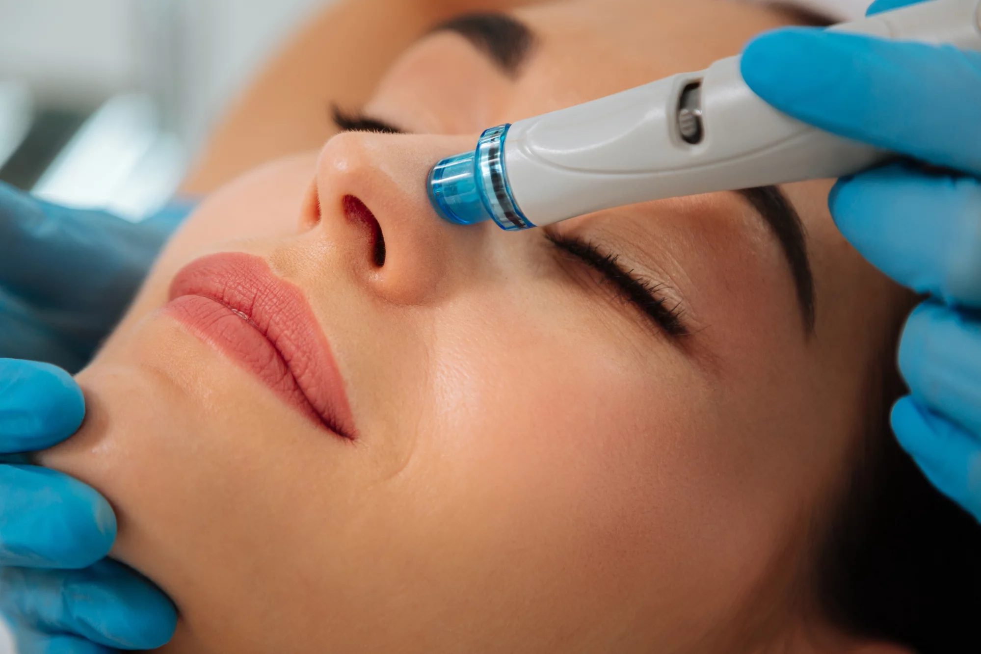 HydraFacial®