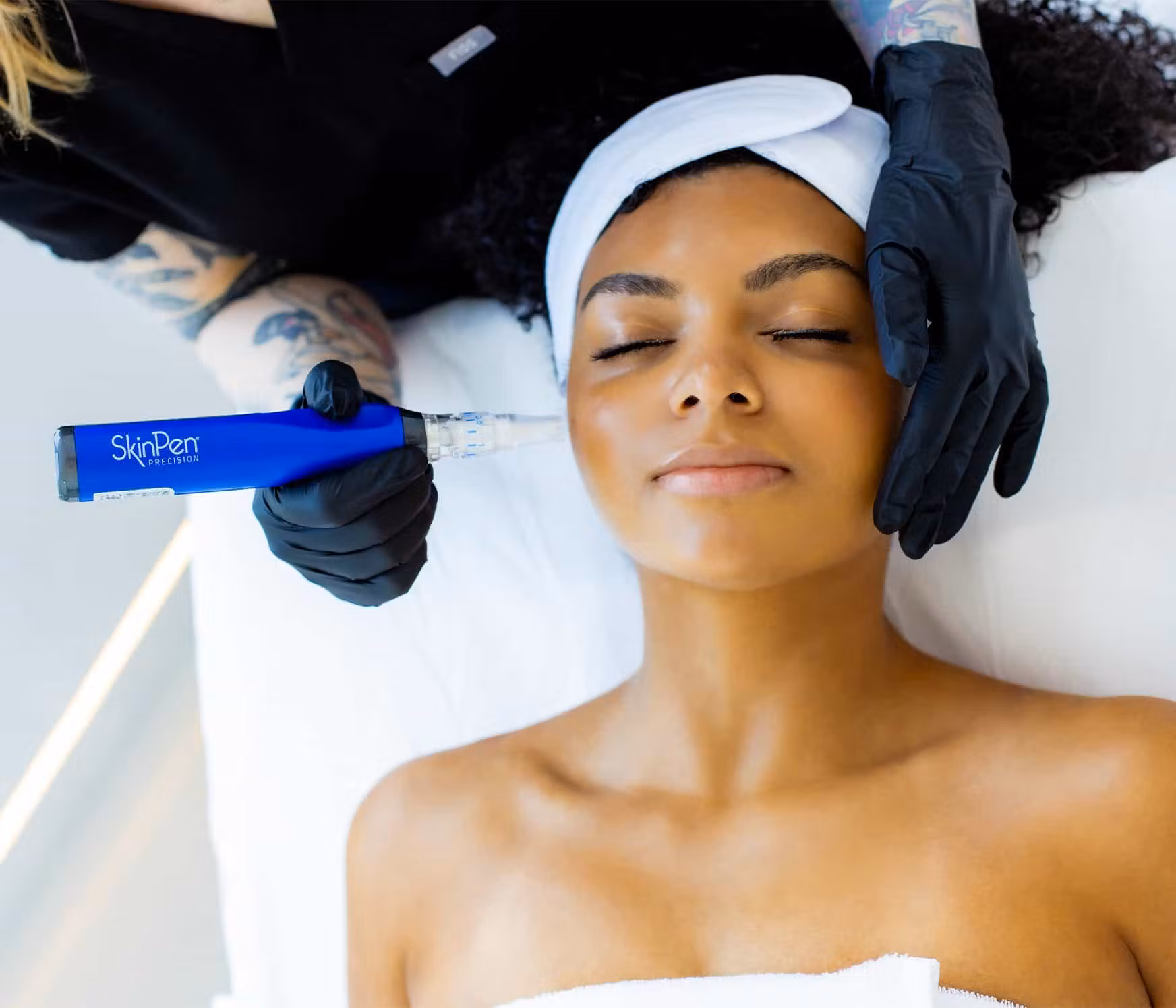 SkinPen® Microneedling